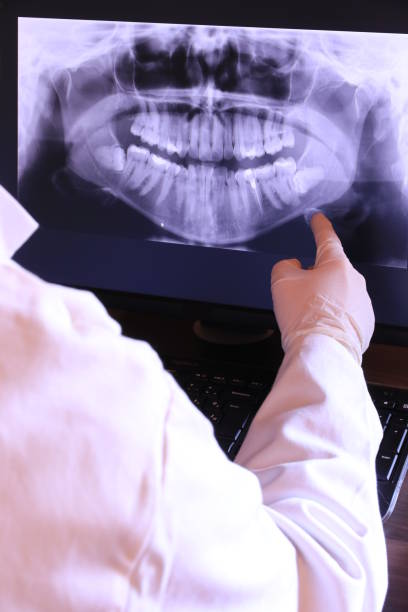Best Chipped Tooth Repair Near Me  in Lake Secession, SC